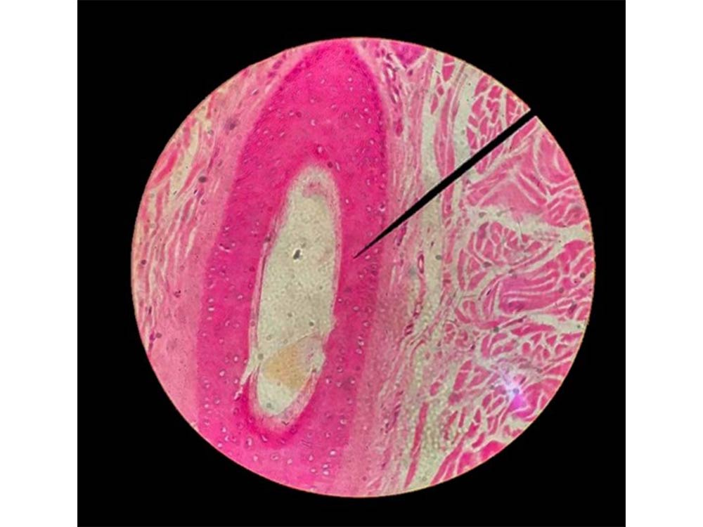 Think urethra